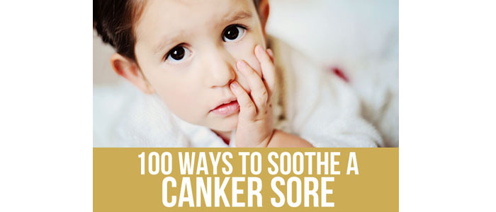 100 Ways to Soothe a Canker Sore